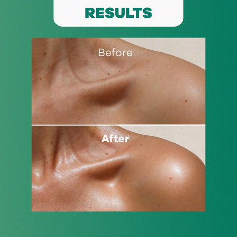 Aceite Corporal de Coco para Hidratación y Suavidad
